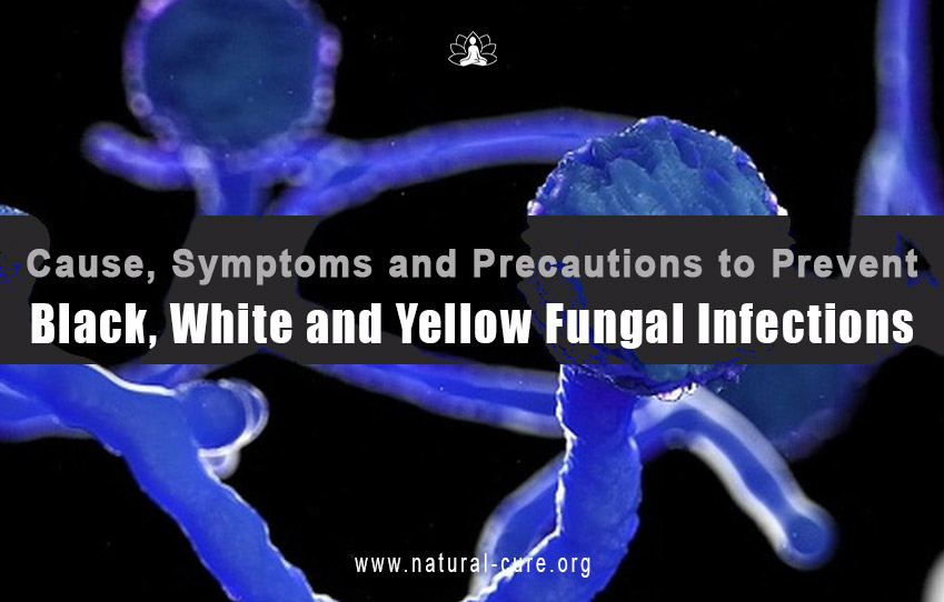 Black-White-Yellow-Fungus